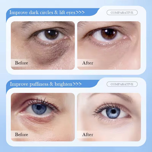 SADOER 8D Hyaluronic Acid Anti-Wrinkle Eye Cream – Deep Hydration & Youthful Eyes ( The Savings Spot Sale )