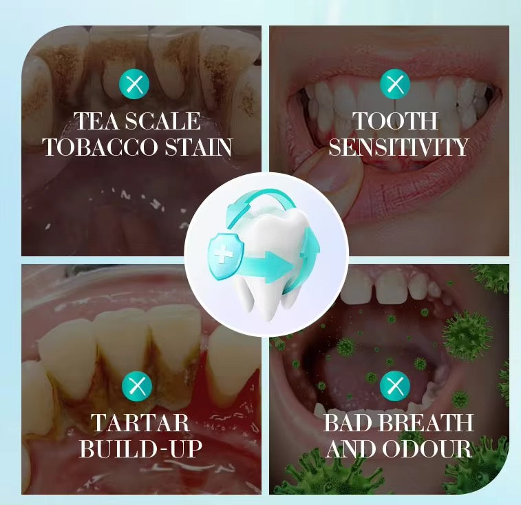 SADOER Whitening Toothpaste ( The Savings Spot Sale )