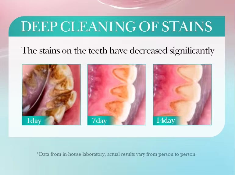 SADOER Whitening Toothpaste ( The Savings Spot Sale )
