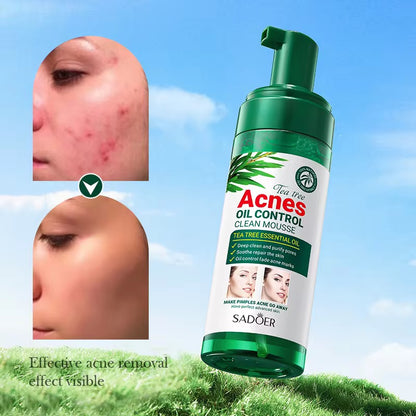 SADOER Tea Tree Acne Oil Control Clean Mousse – Deep Cleansing & Clear Skin Care ( The Savings Spot Sale )
