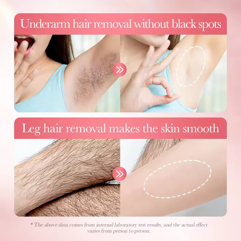 SADOER Hair Removal Mousse Silky — Silky Smooth Skin, Easy & Painless Hair Removal ( The Savings Spot Sale )