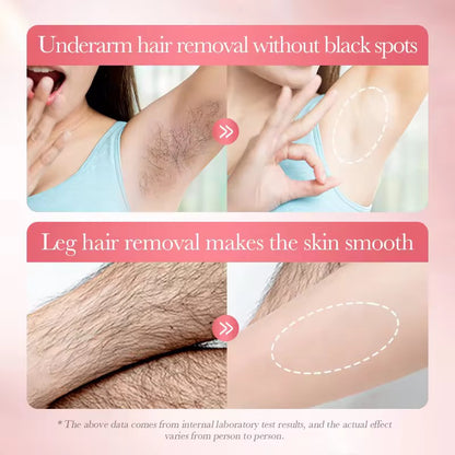 SADOER Hair Removal Mousse Silky — Silky Smooth Skin, Easy & Painless Hair Removal ( The Savings Spot Sale )