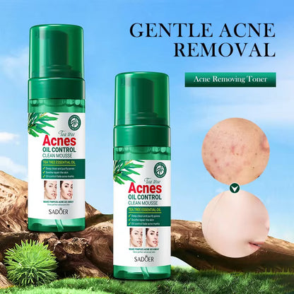 SADOER Tea Tree Acne Oil Control Clean Mousse – Deep Cleansing & Clear Skin Care ( The Savings Spot Sale )