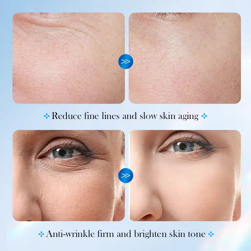 SADOER 8D Hyaluronic Acid Anti-Aging Freeze Day Set – Deep Hydration & Youthful Glow ( The Savings Spot Sale )