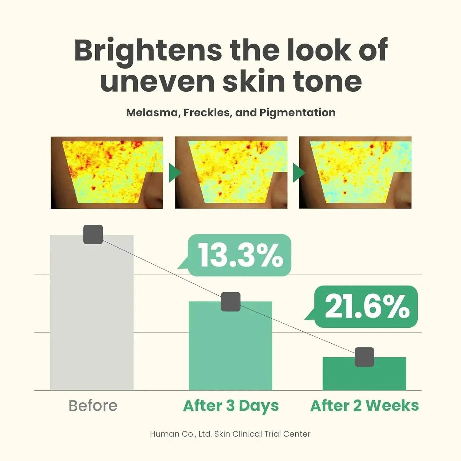 AXIS-Y Dark Spot Correcting Glow Serum | Brighten & Even Skin - The Body Essential